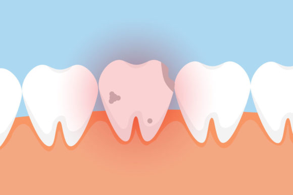 A Bad Tooth with Pain Signal Vector: A Bold Visual Statement